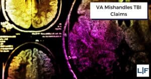 va mishandles tbi claims title on brain mri scan